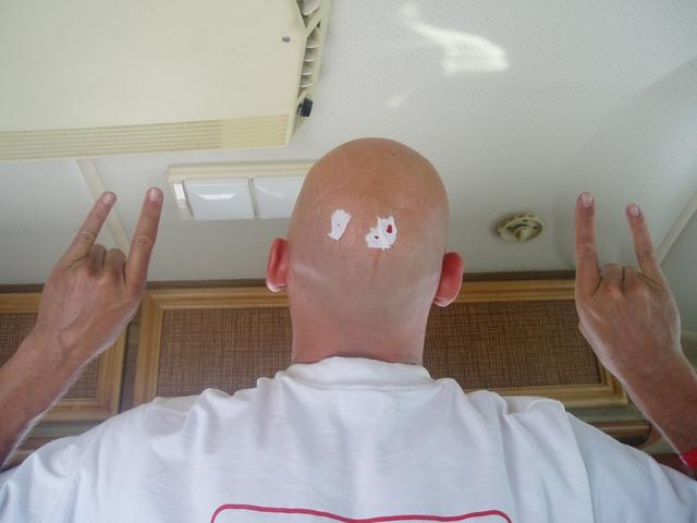 Mojo shaves his head. Ouch.